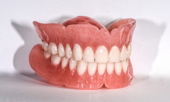 Do you remove dentures in post mortem care